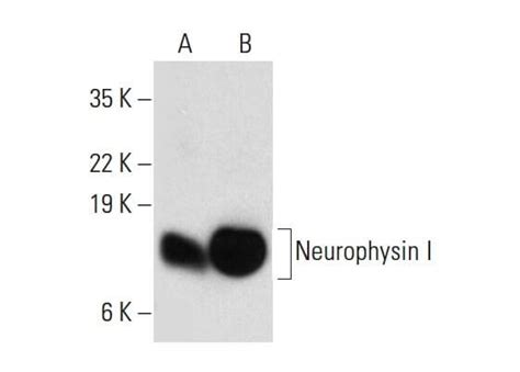 Neurophysin I抗体 D 11 SCBT Santa Cruz Biotechnology