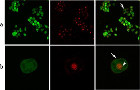 Routes and mechanisms of extracellular vesicle uptake | Exosome RNA