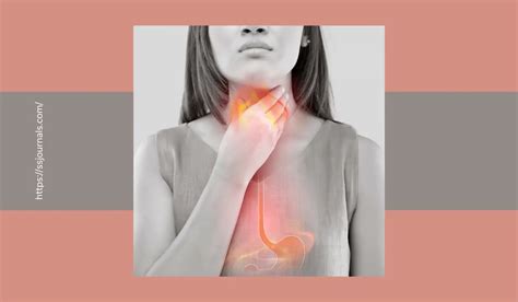 Remedies To Soothe Acid Reflux And GERD Symptoms