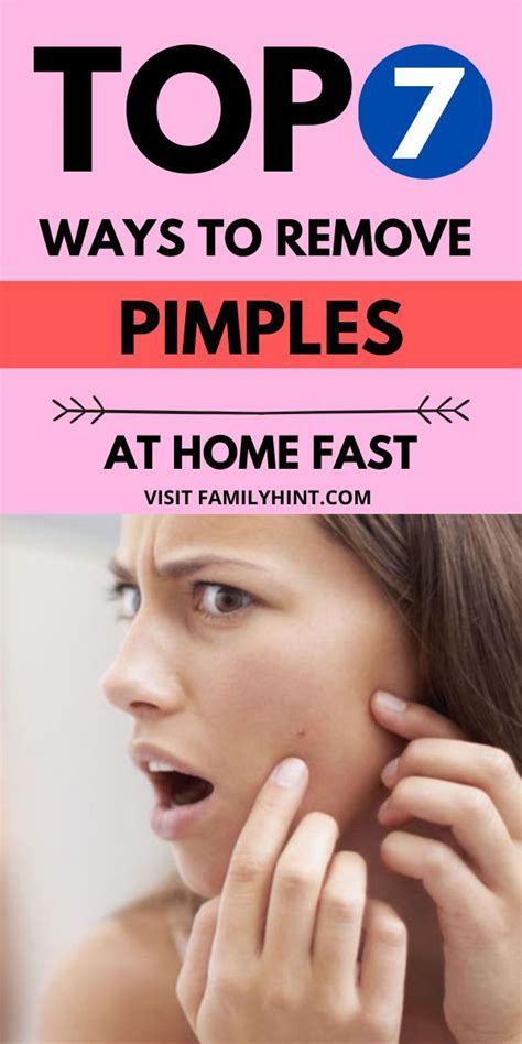 How To Get Rid Of Pimples Overnight At Home Artofit