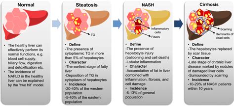 The Diagram Of Progression Of Nonalcoholic Fatty Liver Disease Tg