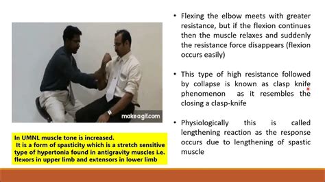 Clasp Knife Spasticity Is A Sign Of Upper Motor Neuron Lesion By Prof