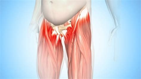 Best Exercises For Hip Tendonitis | Best Diagram Collection