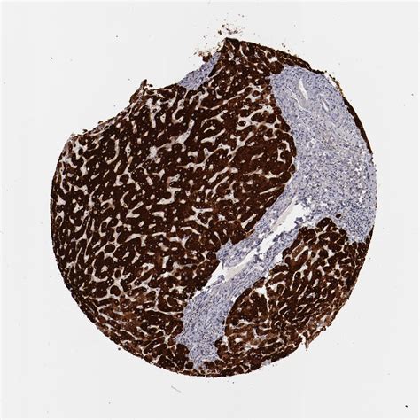 Tissue Expression Of Mbl Staining In Liver The Human Protein Atlas