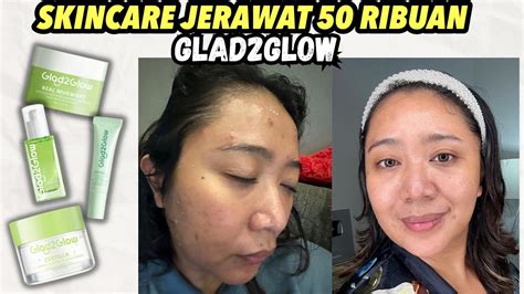 Review Skincare 50 Ribuan Glad2glow Cara Menghilangkan Jerawat Dengan Cepat Dan Mudah Youtube