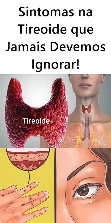 Sinais De Problema Na Tireoide Que Jamais Deve Ignorar Blog