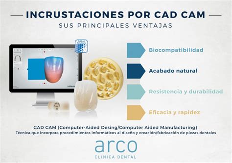 Ventajas de las incrustaciones por método CAD CAM Arco Clínica Dental