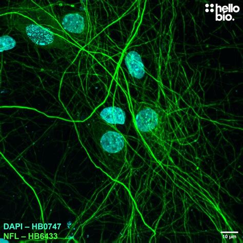 Anti Neurofilament L Antibody Validab Neuronal Marker Mouse