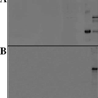 Mechanism Of Bsp Mediated Sperm Capacitation Modified From Therien Et