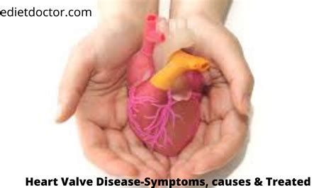 Heart Valve Disease-Symptoms, causes & Treated