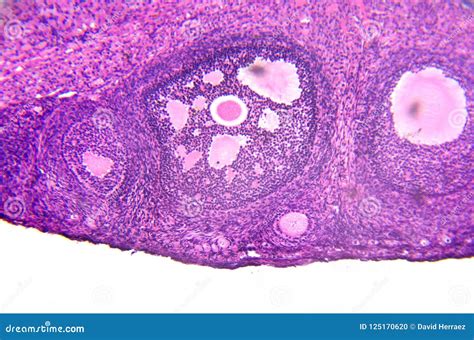 Micrograph Of Ovary Showing Primordial Primary And Secondary Follicles