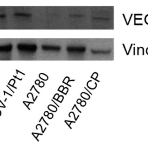 Western Blot Analysis Of Vegfr2 Levels In Different Ovarian Carcinoma Download Scientific