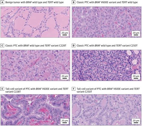 Facilitation Of Definitive Cancer Diagnosis With Quantitative Molecular