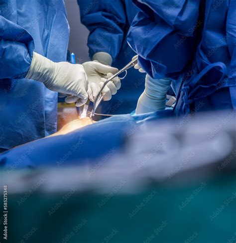 A Surgeon Or Doctor With Nurse Team In Blue Uniform Did Surgery Inside