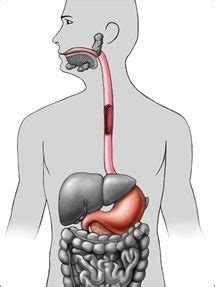 Upper Gi Tract Acadiana Gastroenterology Associates