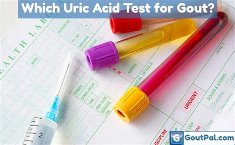 Uric Acid Test Goutpal Gout Help