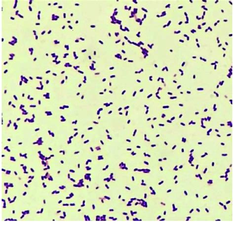 Mengenal Listeria Monocytogenes Inaktivasinya Dengan Panas Mikrobio Id