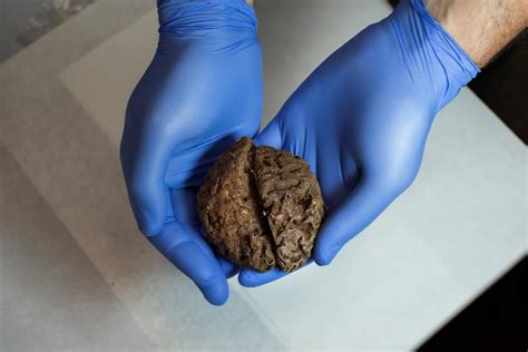 Mass Grave Yields Dozens Of Naturally Preserved Brains Archaeofeed