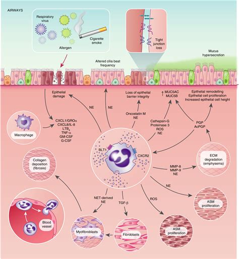 Our Evolving View Of Neutrophils In Defining The Pathology Of Chronic