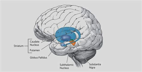 Overview Of Huntingtons Disease Huntingtons Disease Society Of America