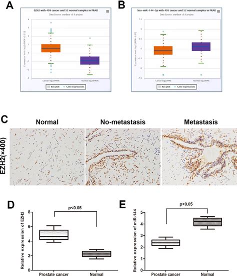 High Expression Of Ezh Correlates With Downregulation Of Mir In