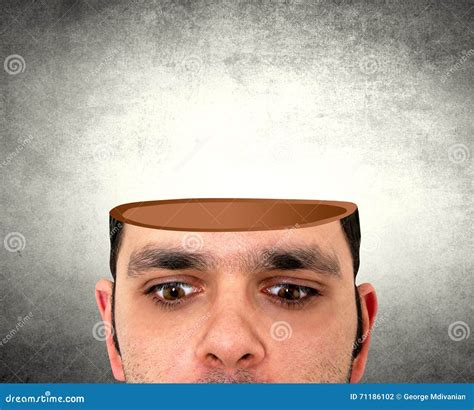 In The Man`s Open Head The Brain Glues Stickers To Itself The Concept