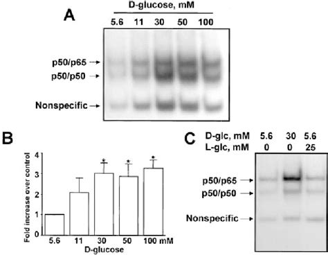 Figure 1 From Role Of High GlucoseInduced Nuclear Factor B Activation