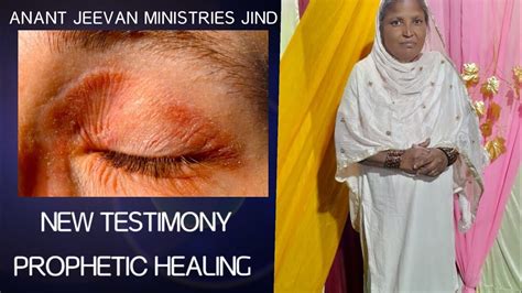 Prophetic Healing New Testimony 🔥 Anant Jeevan Ministries Jind Haryana Youtube