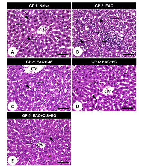 Photomicrographs Of Liver Sections Stained With Hematoxylin And Eosin