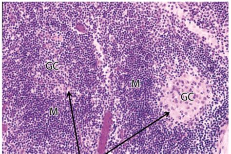 Histology Lymph And Blood CV Flashcards Quizlet