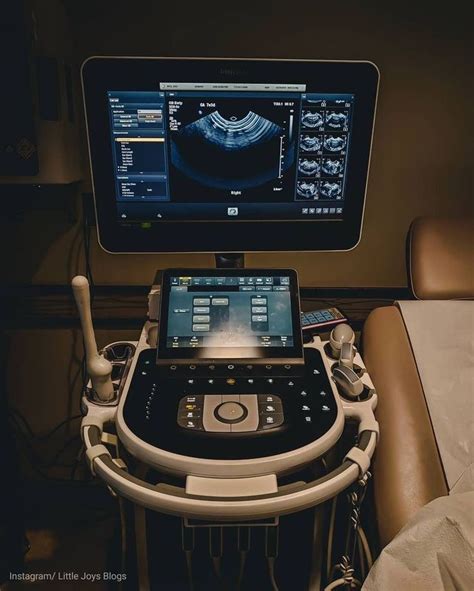 Sonography school – Artofit