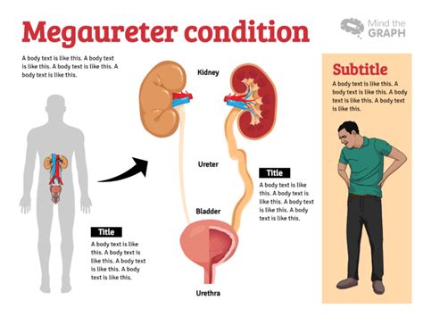 Kidneys Everything To Create Your Graphical Abstract Mind The Graph Blog