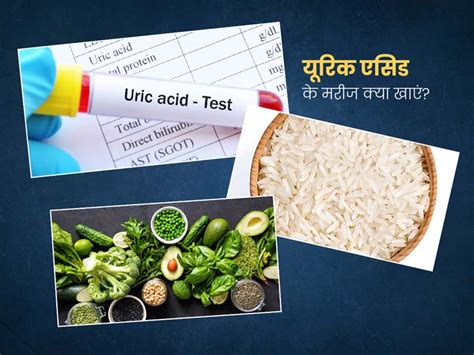 यूरिक एसिड के मरीजों को क्या खाना चाहिए और क्या नहीं जानें एक्सपर्ट से Uric Acid Patient Diet