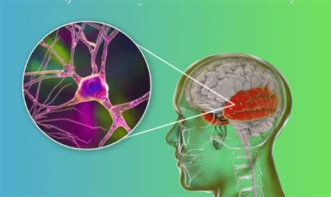 Wow Neuralinks Brain Chip Enables Very 1st Human Patient To Control