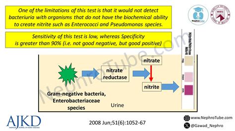 Urinary Tract Infection Clinical Tips Dr Gawad Ppt