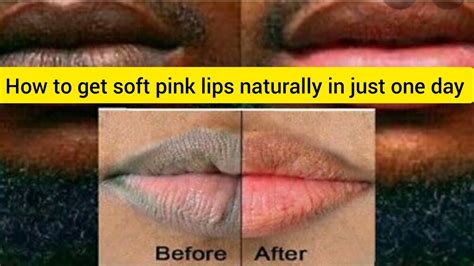 Get Soft Pink Lips Naturally At Home Just In 1day Home Remedy 👄👄 Youtube