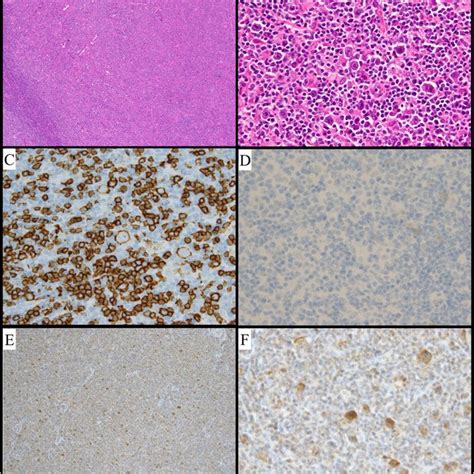 Histological Findings For A Biopsy Specimen A Hematoxylin Eosin He