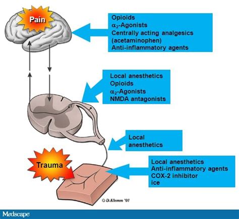 New And Emerging Treatment Options For Acute Postoperative Pain In The