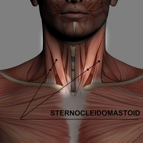 Headache Self Massage Scm Sternocleidomastoid Restorative Health And