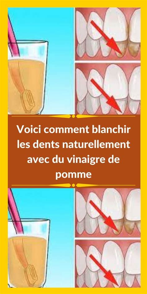 Voici Comment Blanchir Les Dents Naturellement Avec Du Vinaigre De