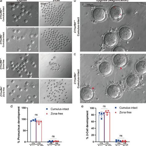 The Fertilization Of Sperm And Oocytes At Different Times After IVF Was