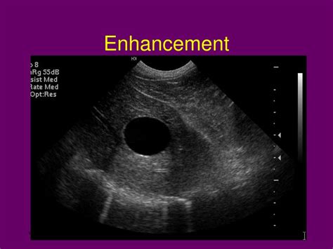 Ppt Ultrasonography Powerpoint Presentation Free Download Id623027