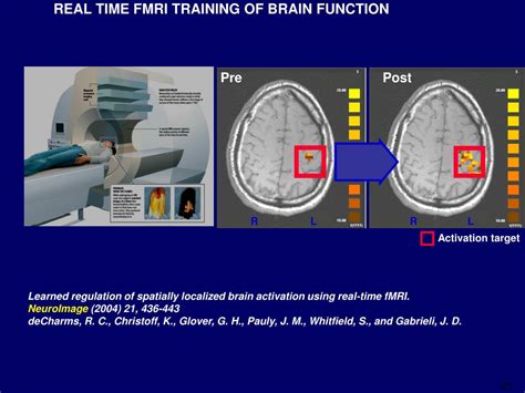 Ppt Applications Of Real Time Fmri Pain Treatment And Substance