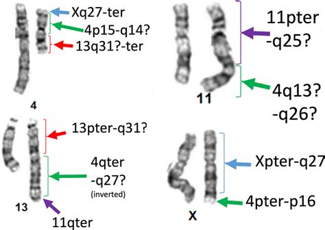 chromosome cytogenetics modern molecular cytogenetic techniques