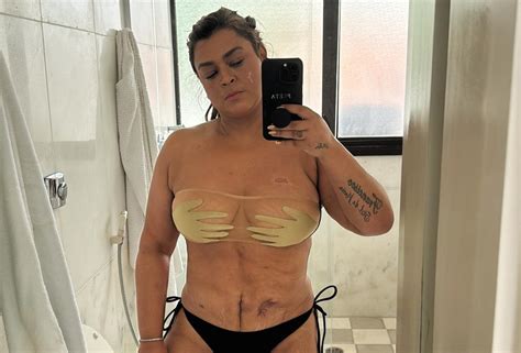 Preta Gil Rebate Seguidora Que Criticou Cicatrizes Mostra Em Foto De