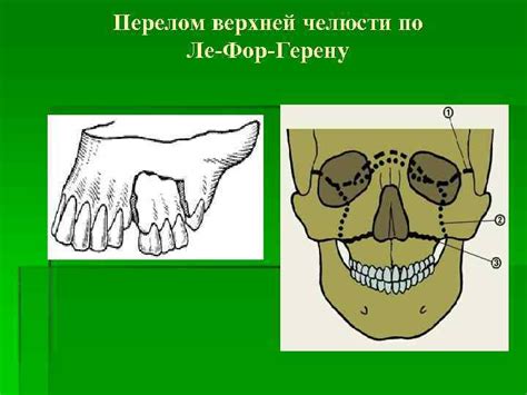 Травмы зубов альвеолярного отростка и челюстных костей Доцент