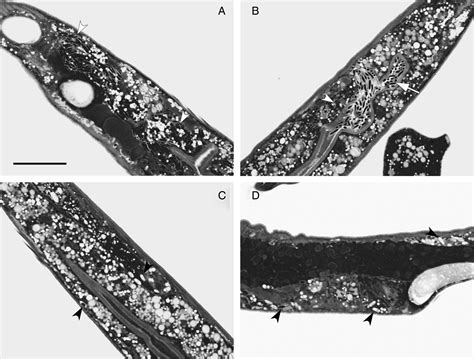 A New Microsporidium Percutemincola Moriokae Gen Nov Sp Nov From