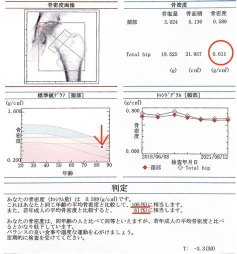 おおつか整形外科blog コラム 2021年9月号 骨粗鬆症 熊本市東区の整形外科｜おおつか整形外科｜スポーツ整形外科