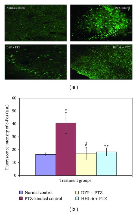 A Photomicrograph Of C Fos Immunoreactivity In Cortical Region Of