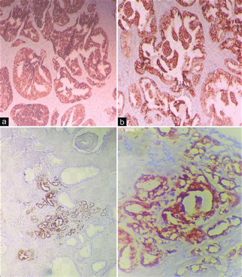 Photomicrograph Of Immunohistochemical Expression Of Il10 And Hsp 90 In